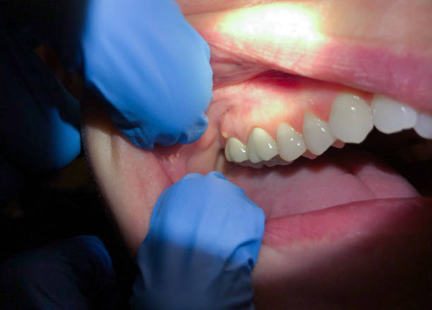 Best Emergency Gum Pain Relief  in Owings, MD