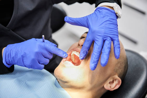 Best Teeth Whitening  in Owings, MD